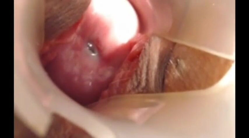 Putarankahotmilf: Long juicy cervix show close up,pencil