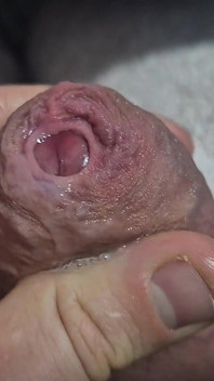 Uncut Tight Phimosis Cock Foreskin Stretched Close up