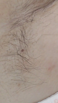 Detailní naolejované naolejované podpaží
