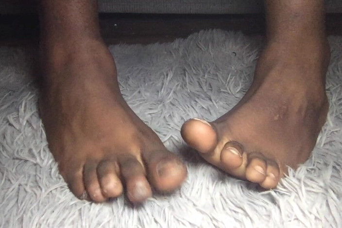 Teddy south: Big Black Feet