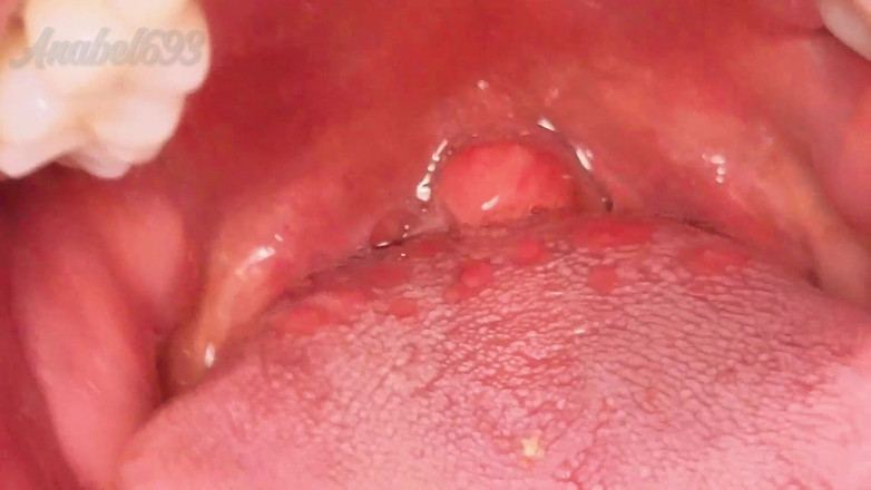 anabel693: Fetiche bucal úvula perto Eu engasgo com um BBC duro