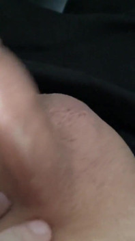 Liten forskin penis