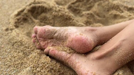 Free!!! Beach Feet