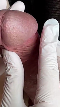 Juego de glande con guantes de látex blancos en super primer plano. Vista alternativa.