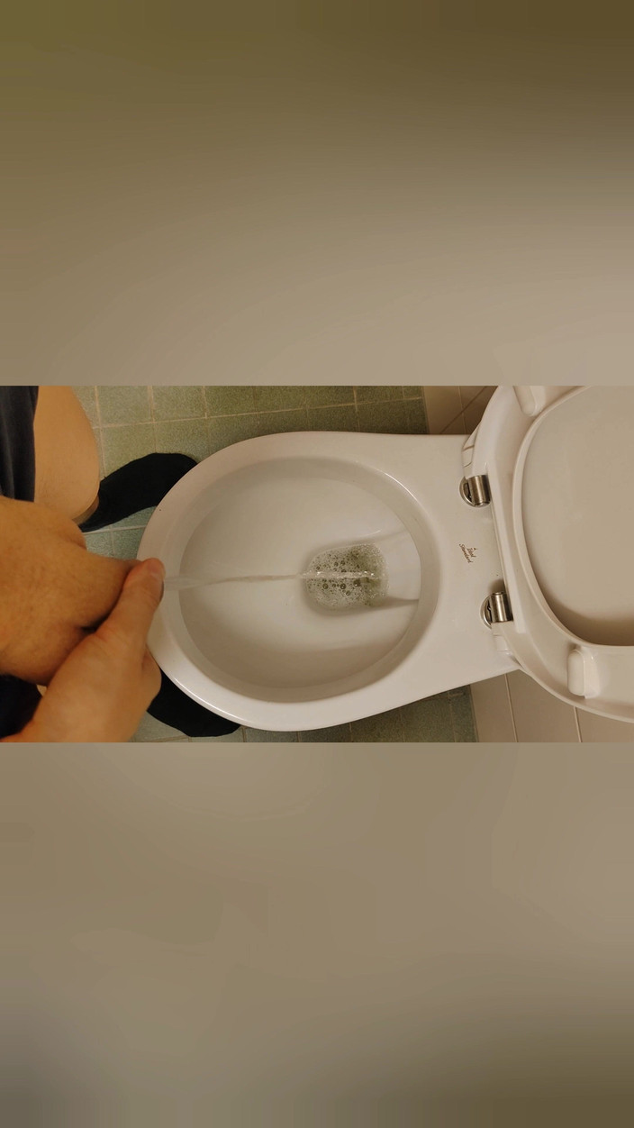 Bayer911: Golden Shower