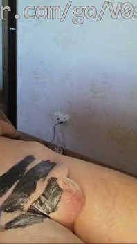 #205(2) Male Waxing. Smooth Penis and Scrotum