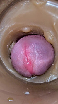 Camera Inside Deep Captures Huge Ejaculation of Sperm 2 Times