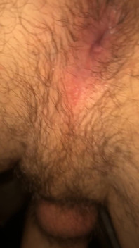 Hairy Twink Hole