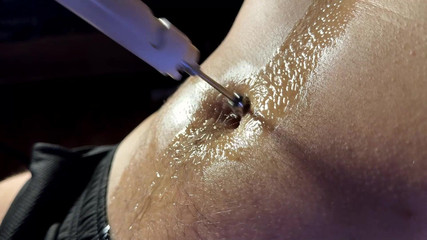 Navel fans: Mechanika bellybuttonu