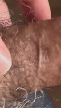 Closeup of Penis with One Vein