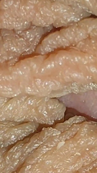 The World's Largest Foreskin Opening and Closing.