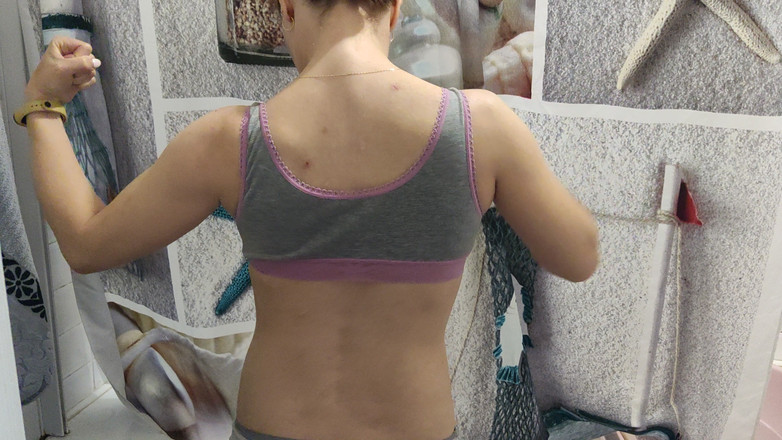 Risky Hairy Couple: 強い腕と背中の屈曲