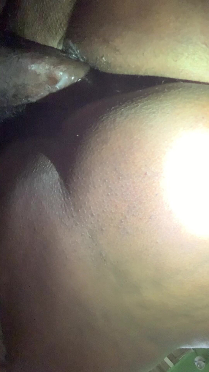 Enyival: La migliore cellulite di sempre