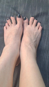 Do We See How Beguiled My Throbbing Foot Veins Are