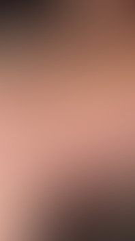 Fisting Anal & Prolapse