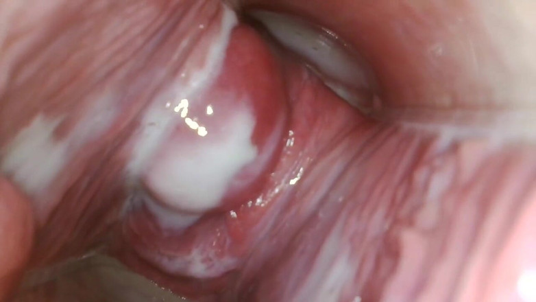 JANA studios: Endoscope in my pussy