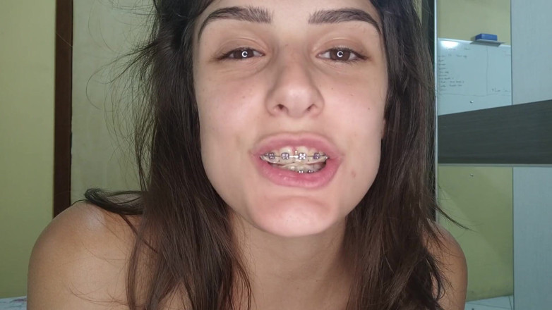 Shamelesscouple: Cum on butterfly braces