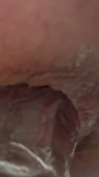 Stretching Out My Hole
