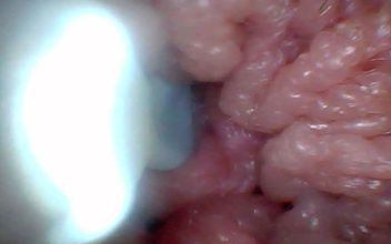Endoscope Camera Shows the Most Sensitive Parts of the Penis Educational Video