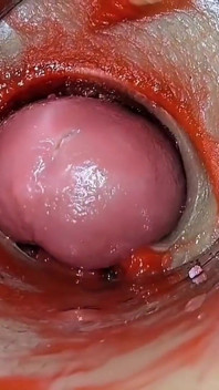 Kompilasi creampie meleleh Cumfeti - Paparan Endoscopy