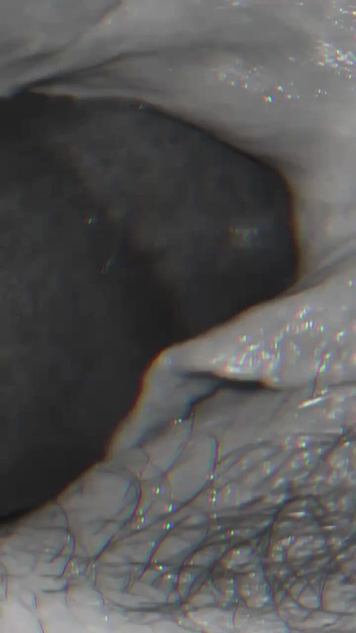 Iiwii 11BBC trans: Två hål en ftm