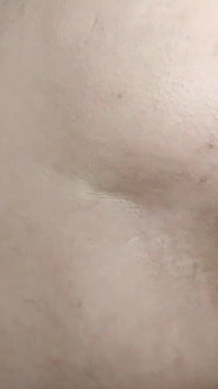 Anale di lato