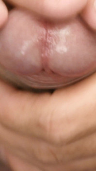 Lobo sục cu