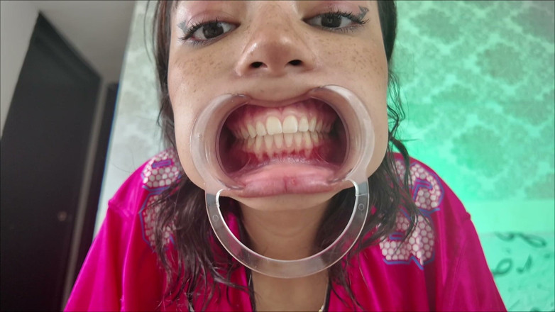 KiyuSweetCrazy: Cheeks Pulled Apart Teeth Exposed