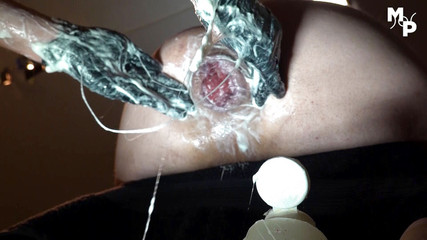 Marcus Pollack Gay: Děrovaný medvěd dostane rozkvetlý růžový zadek