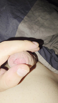 Tease
