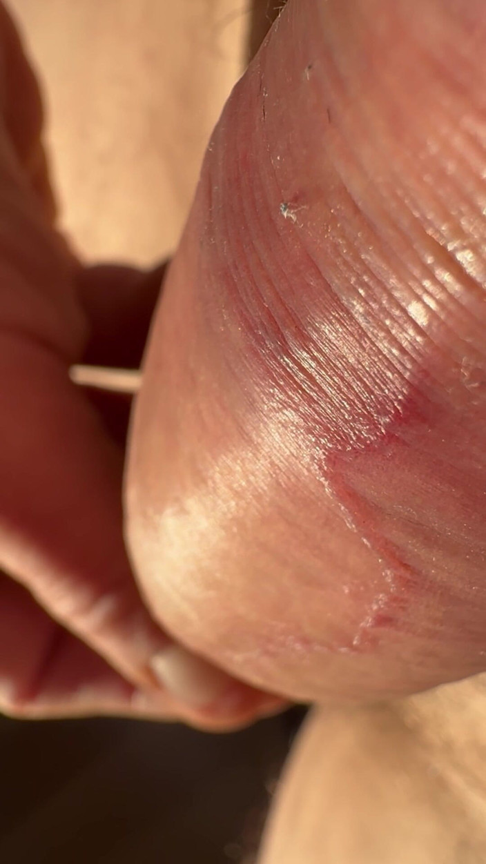 Nalekhome: Kulup kontol macro wet