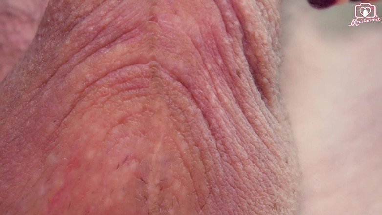 Medi Voi: Spouštěč kamery z pohledu