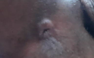 Che: 후장 위에 기름을 넣고 손가락에 대고