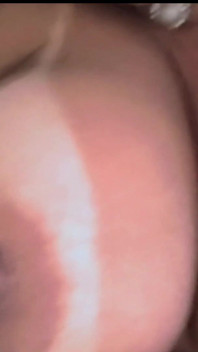 Nipples