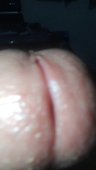 Smegma Big Uncut Smell