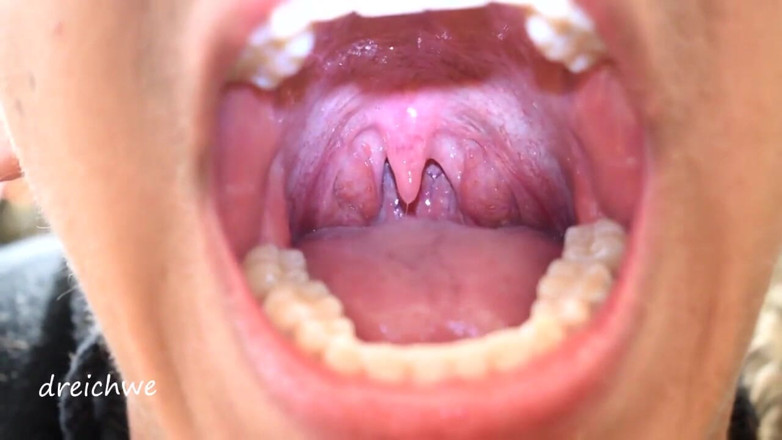 Dreichwe: Uvula фетиш в рот