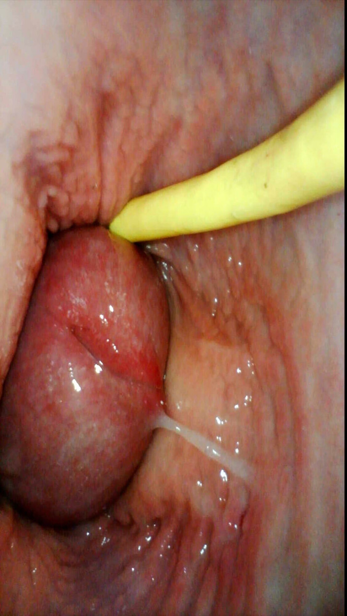 JessiJek: Servant Girl Do Everything I Say - Endoscope in Pussy and...