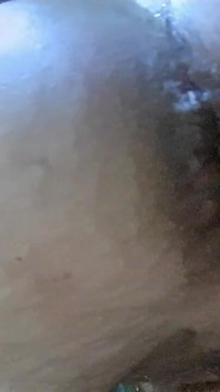Entrenamiento anal y prolapso rectal 2