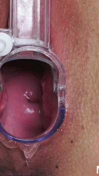 Horny Blonde with Big Meaty Pussy Fingered by Doctor