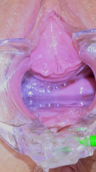 Speculum-examen van heet roze milf poesje