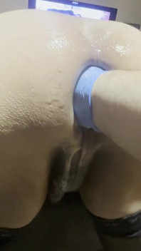 Analmoni Anal Germe