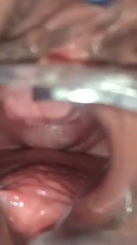 Masturbação com visão do útero e espéculo médico, close-up da minha buceta