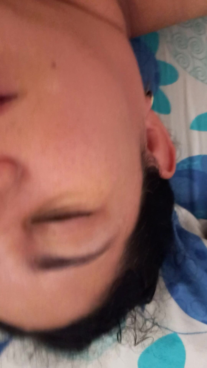 Valkyrie and Luigy Couple: 24. ヴァルキリーのためのミルクヨーグルト プロバイオティクス豊富な健康的なスナック