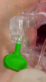 Super Cute Redhead Kaira Love Gets Her Cervix Examined with Speculum