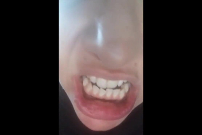 savannahamatoriale: Bella faccia, ma denti marcio!