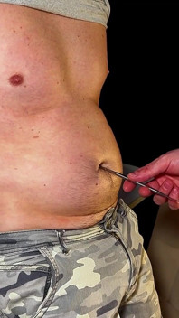 Perfeição inchada - check-up privado