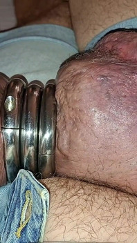 裸露的怪物