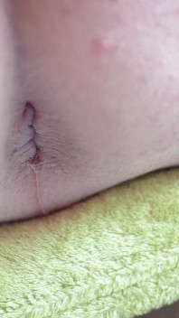 Asshole Closeup