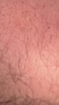 Close up Hairy Hole