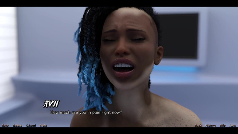 AVN Teller: Stranded in Space 191 - Vitiligo Girl Who Is in Love with...